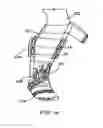 Fig. 08 - Surgical cast venting device and material