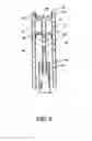 Fig. 06 - Fluid infusion methods for ocular disorder treatment