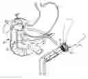 Fig. 01 - PANCREATIOBILIARY DIVERSION DEVICE
