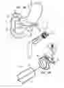 Fig. 07 - PANCREATIOBILIARY DIVERSION DEVICE