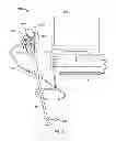 Fig. 04 - Endoscope Control Unit with Braking System