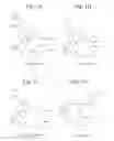 Fig. 02 - Macrolide particulates, methods for preparation, and medical devices associated therewith