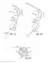 Fig. 06 - Paranasal ostium finder devices and methods