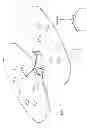 Fig. 04 - Medical anchoring system