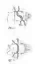 Fig. 07 - Medical anchoring system