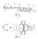 Fig. 10 - Medical anchoring system