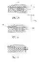 Fig. 11 - Medical anchoring system
