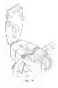 Fig. 14 - Medical anchoring system