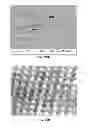 Fig. 17 - Transdermal delivery of high viscosity bioactive agents