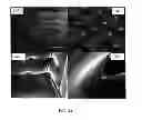 Fig. 22 - Transdermal delivery of high viscosity bioactive agents