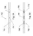 Fig. 08 - Steerable guidewire and method of use