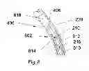 Fig. 09 - Steerable guidewire and method of use