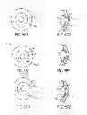 Fig. 07 - Laser fiducials for axis alignment in cataract surgery