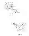 Fig. 09 - Laser fiducials for axis alignment in cataract surgery