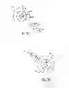 Fig. 10 - Laser fiducials for axis alignment in cataract surgery