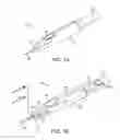 Fig. 02 - Cryogenic enhancement of joint function, alleviation of joint stiffness and/or alleviation of pain associated with osteoarthritis