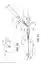Fig. 06 - System and method for positioning implantable medical devices within coronary veins