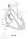 Fig. 15 - System and method for positioning implantable medical devices within coronary veins