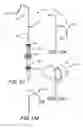 Fig. 17 - System and method for positioning implantable medical devices within coronary veins