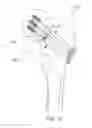 Fig. 16 - Bone screw system and method