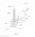 Fig. 07 - Bone graft harvesting device and method of use