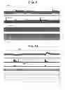 Fig. 07 - Electrical treatment of bronchial constriction