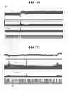 Fig. 09 - Electrical treatment of bronchial constriction
