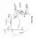 Fig. 06 - Systems and devices for a counter balanced surgical robot