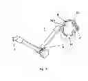 Fig. 04 - Method and a device for computer assisted surgery