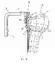 Fig. 07 - Method and a device for computer assisted surgery