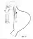 Fig. 14 - Methods and devices for manipulating and fastening tissue