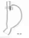 Fig. 23 - Methods and devices for manipulating and fastening tissue