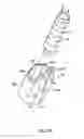 Fig. 32 - Methods and devices for manipulating and fastening tissue