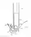 Fig. 35 - Methods and devices for manipulating and fastening tissue