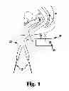 Fig. 02 - Implants, tools, and methods for treatment of pelvic conditions