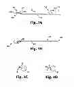 Fig. 04 - Implants, tools, and methods for treatment of pelvic conditions