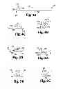 Fig. 05 - Implants, tools, and methods for treatment of pelvic conditions