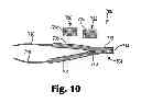 Fig. 10 - Implants, tools, and methods for treatment of pelvic conditions