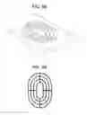 Fig. 04 - Surgical Implant Comprising a Layer Having Openings