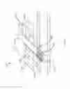 Fig. 20 - Deployment tool for sutureless vascular anastomosis connection