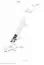 Fig. 32 - Deployment tool for sutureless vascular anastomosis connection
