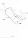 Fig. 35 - Deployment tool for sutureless vascular anastomosis connection