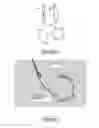 Fig. 06 - Methods and apparatus for magnet-induced compression anastomosis between adjacent organs