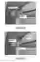 Fig. 08 - Methods and apparatus for magnet-induced compression anastomosis between adjacent organs