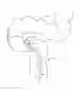 Fig. 01 - Diverticula removal clamp