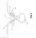 Fig. 10 - Diverticula removal clamp