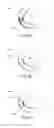Fig. 08 - Catheter with vessel lining and methods for using same