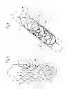 Fig. 05 - Thrombectomy device