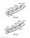 Fig. 22 - ENDOLUMINAL FILTER WITH FIXATION