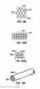 Fig. 28 - ENDOLUMINAL FILTER WITH FIXATION